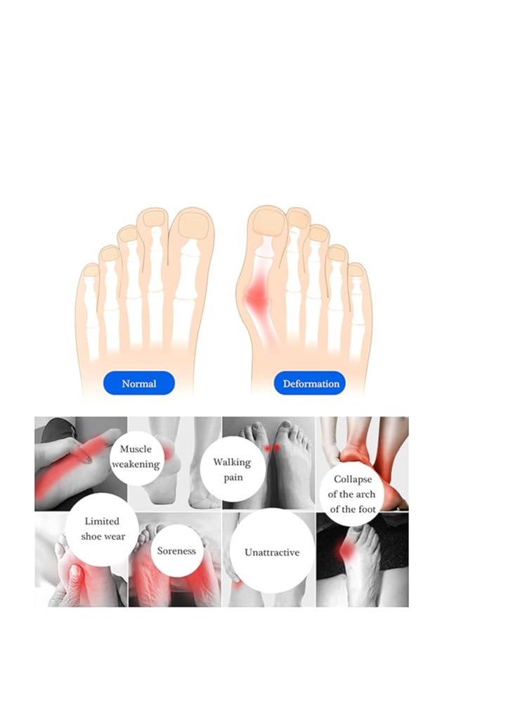 Spaceshoop 2 Pairs Honeycomb Fabric Forefoot Pads Men Women Soft Metatarsal Pads Soft Gel Ball of Foot Cushions for Relieving Foot Fatigue  - Image 2
