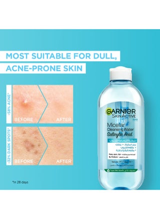 Garnier Skinactive Micellar Cleansing Water, with Salicylic Acid, For Acne Prone Skin 400ml - view 5