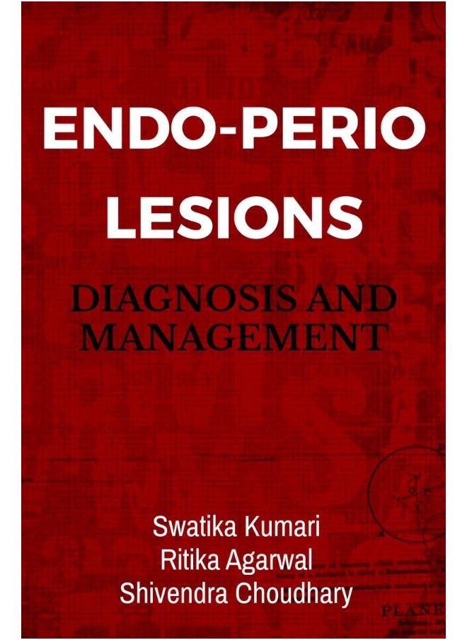 Endo-Perio Lesions : Diagnosis and Management  - Image 2