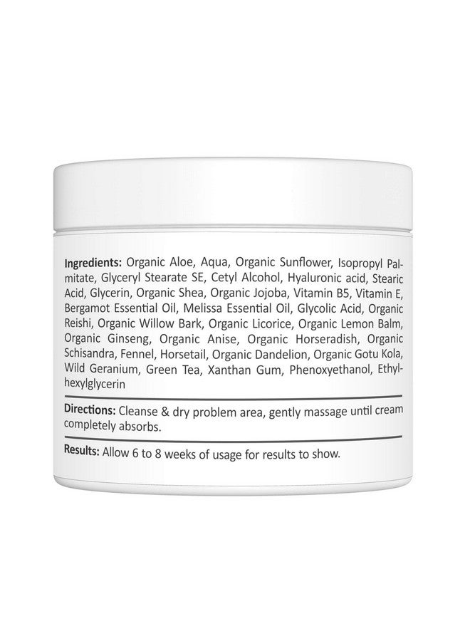Pink Madison Dark Spot Corrector Best Age Spot Remover Treatment for Face Hands Body Circle 4 Ounce Cream - Image 2