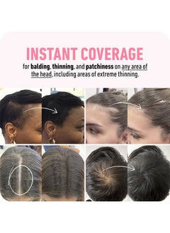 Boldify BOLDIFY Hairline Powder - Root Touch Up Hair Color for Gray Coverage - Bald Spot Concealing Hair Powder for Women & Men - 48-Hour Stain-Proof - Black  - Image 4