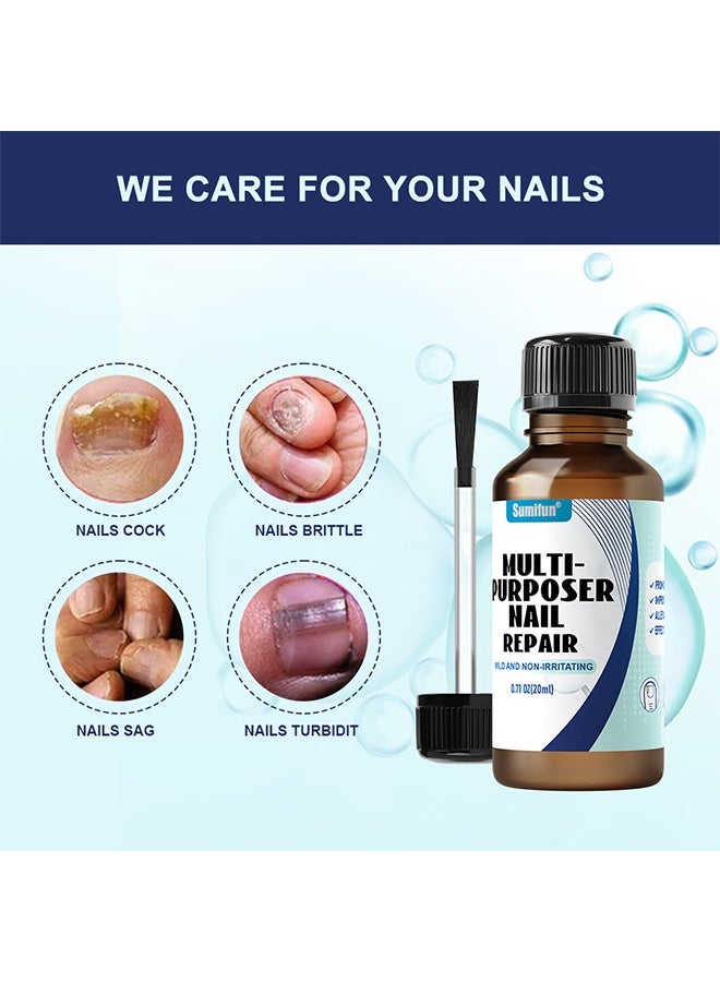 Sumifun Multi-Purpose Nail Repair Fungus Treatment Toenail Fingernail Fungal Renewal Treatment Toenail Fungus Treatment Solution Nail Psoriasis Aging Nails Fungus Damaged Repair Gel 20ML - Image 4