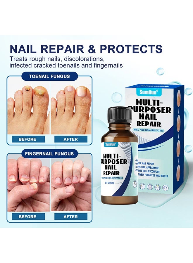 Sumifun Multi-Purpose Nail Repair Fungus Treatment Toenail Fingernail Fungal Renewal Treatment Toenail Fungus Treatment Solution Nail Psoriasis Aging Nails Fungus Damaged Repair Gel 20ML - Image 5