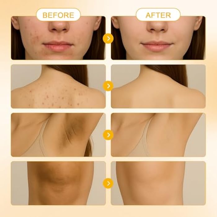 Peehss Turmeric Soap & Turmeric Face Wash Set, Honey Lemon Tumeric Kojic Soap Bar & Facial Cleanser Combo for Face & Body, Evens Skin Tone Deep Cleansing Moisturizing - Image 4