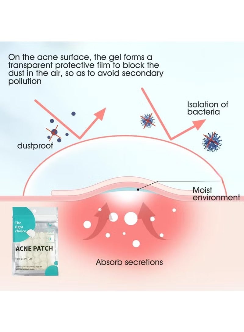 ATRJSZ Acne Pimple Patches,Hydrocolloid Acne Patch for Covering Face, Blemishes, Zits Absorbing Patch,Cosmetics Patch for Pimple Dots, Acne Treatment, Invisible Acne Spot Patches(150 Count) - Image 4