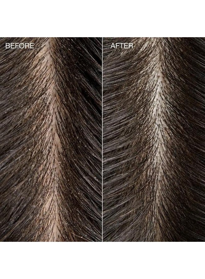 Tea Tree Special Detox Foaming Salt Scrub, Exfoliates, Refreshes Scalp, For All Hair Types, 6.5 oz. - Image 4