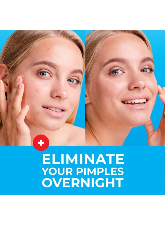 KEYCONCEPTS PatchRx Pimple Patches for Face (500 Patches), Hydrocolloid Acne Patches with Tea Tree Oil, Pimple Patch Pimple Stickers - Hydrocolloid Patch Acne Dots - Acne Pimple Patches For Face - Zit Patches - Image 2