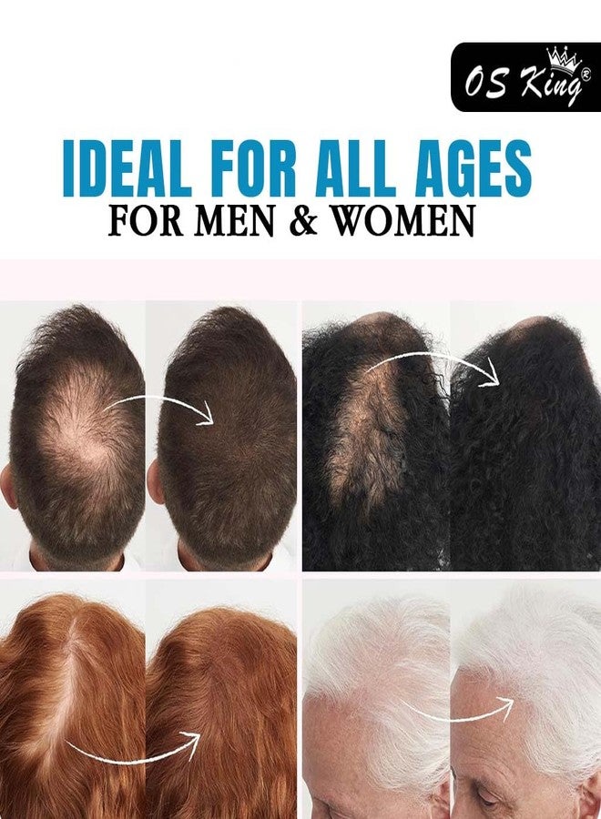 Osking Hair Fiber For Damaged Hair Building Fiber 28 gm Bottle Medium Brown Hair Fiber (28 g Medium Brown) - Image 5