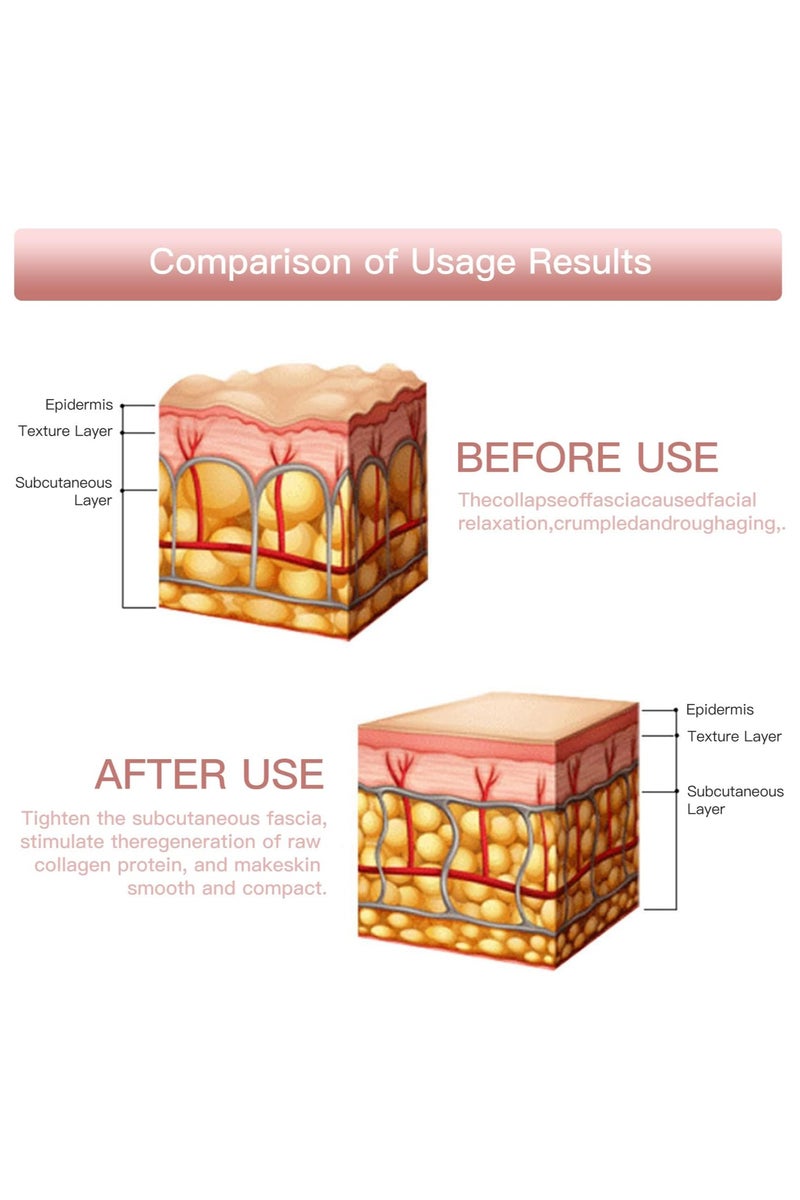 ميني جهاز صغير لتجميل الوجه، 5 سرعات و3 أوضاع لتجديد شباب البشرة، جهاز تجميل البشرة للنساء والذقن والعينين، يساعد على تقليل التجاعيد، (تصنيع اوروبي) - Image 5