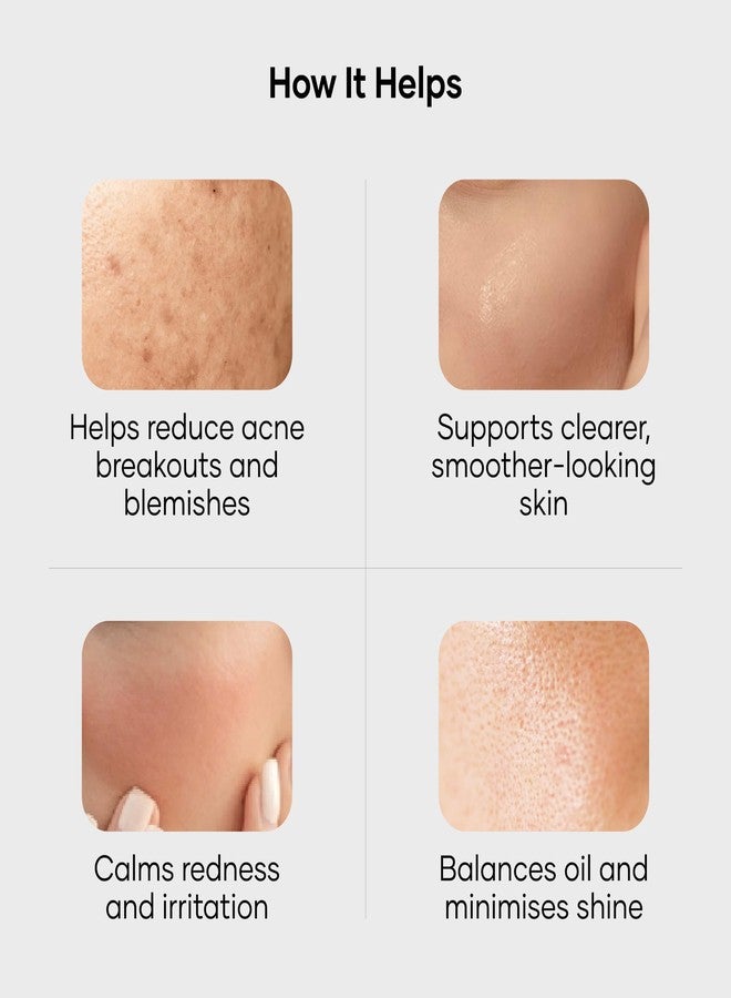 Cureskin جل كيورسكين لعلاج حب الشباب الموضعي مع حمض الماندليك | جل لإزالة البثور لحب الشباب النشط والاحمرار والبقع الداكنة | مصحح سريع المفعول للبقع للرجال والنساء | 10 غرام - Image 4