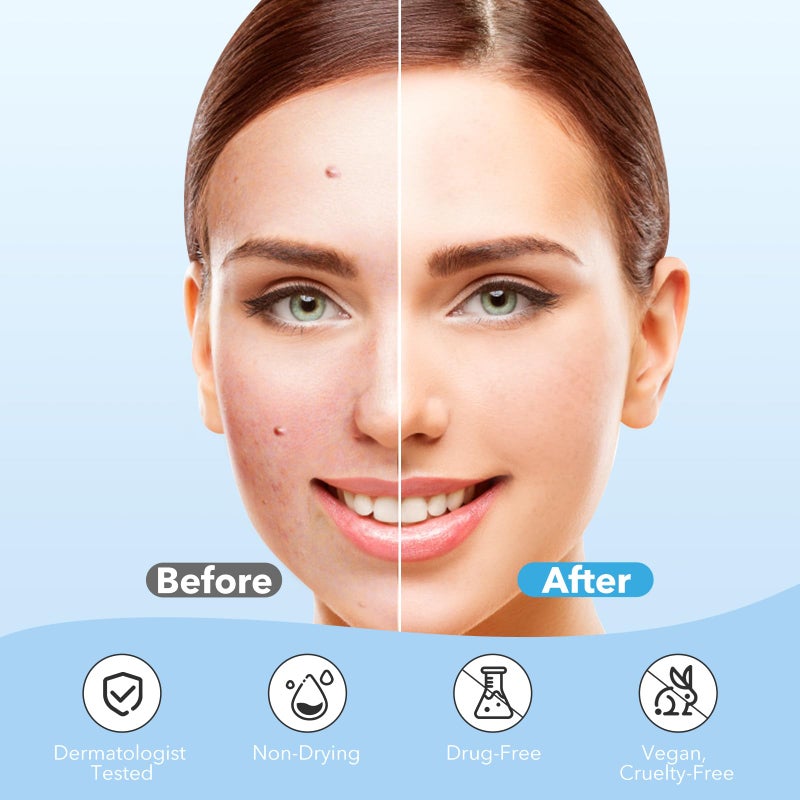 QUSTERE Pimple Patches for Face, Hydrocolloid Acne Patches, Cute Round Shape Zit Covers, Spot Stickers with Tea Tree, Salicylic Acid & Cica Oil| 2 Sizes (9mm, 12mm) |288 Count - Image 4