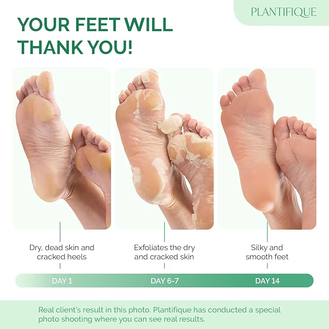 Plantifique Foot Peel Mask 2 Pairs Exfoliating Dermatologically Tested Foot Treatment Removes Dead Skin Repairs Heels for Soft Feet Peach Scent Gift for Women Men - Image 2