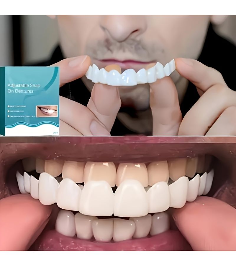 Adjustable Denture Liner For Comfortable Fit Easy Installation And Natural Smile 1 Box - Image 2