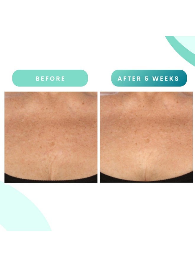 سيريوس سكين كير Serious Skincare - كريم الجسم المجدد لشد البشرة بالجليكوليك - مرطب - مرطب للبشرة الجافة - BODY FIT™ - للبشرة المتجعدة والمترهلة - تقشير لطيف لبشرة أكثر نعومة - 8 أونصة سائلة.  - Image 5