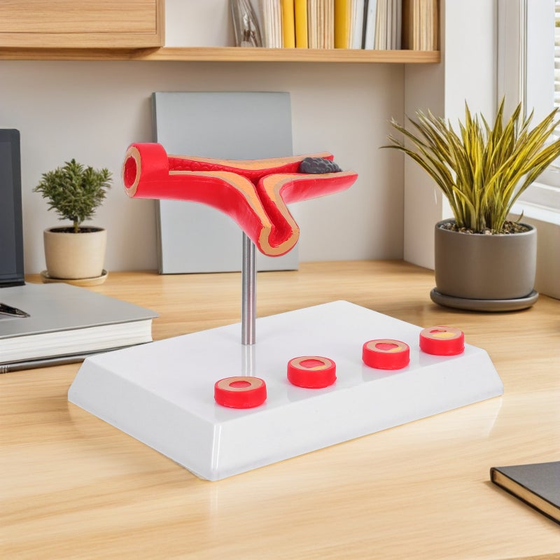 2pcs Vessel Model - Cardiovascular Model For Education Display Tool Anatomy Supplies - Image 3