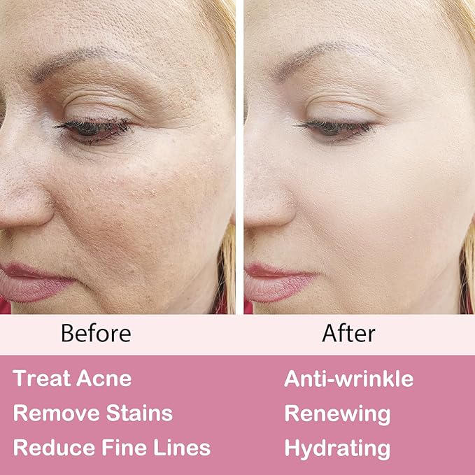 sefuson Retinol Moisturizer CreamFor FaceEye Area Anti Aging Wrinkles Acne Fine Lineswith Vitamin EHyaluronic Acid Jojoba OilBest NightDay Facial CreamWith 25 Active Retinol 50Milliliter - Image 5