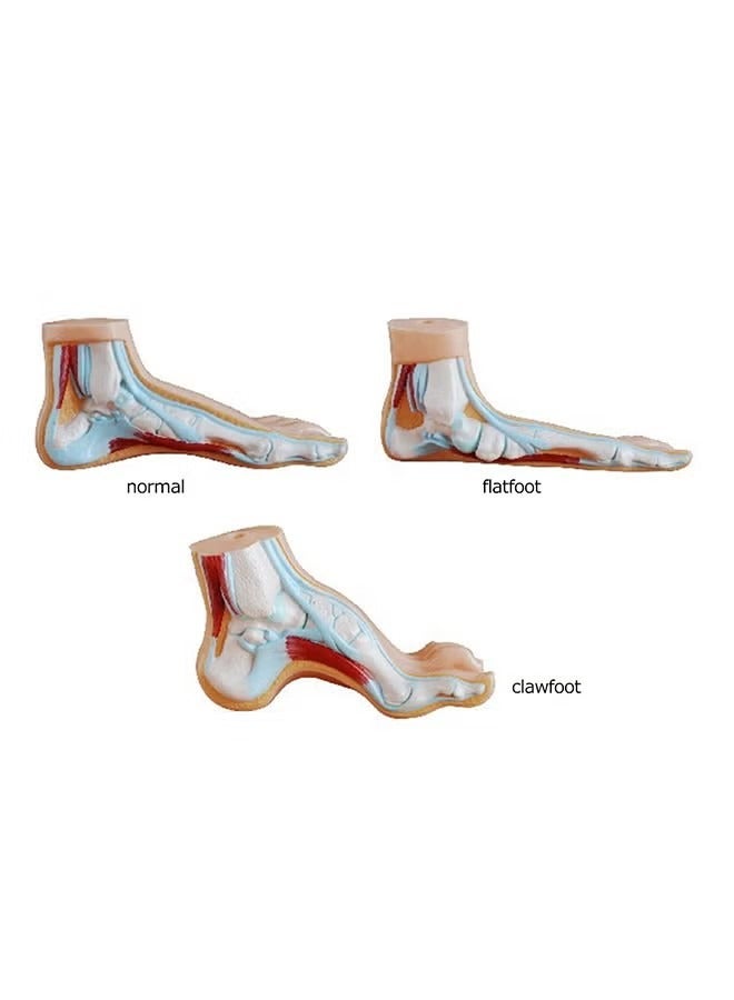 ORiTi Pair Of Shoes Cushion Pad With Silicone Ball Foot Insoles - Image 3