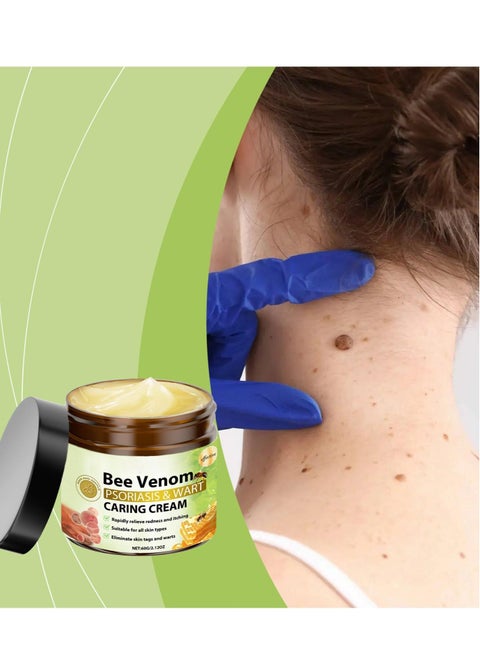 Bee Venom Mole and Wart Care Cream Reduce skin Moles and Warts Clean Repair Smooth skin care cream