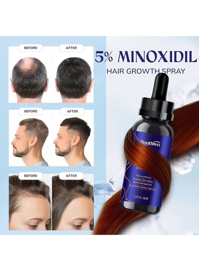 RootStim 5% Minoxidil Hair Growth, Beard Growth Kit for Men and Women: Extra Strength Minoxidil Hair Loss Treatment Serum with Rosemary for Faster Stronger Thicker Hair Growth 2 Fl Oz - Image 4