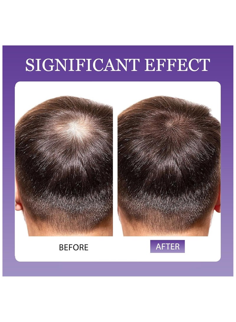 Kirkland Signature 5% Minoxidil Spray for Men Women, 2 pcs 30ml Minoxidil for Women Hair Growth, Minoxidil for Men Hair and Beard Growth Spray - Image 3