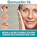 Dermactin-TS Stretch Mark Complex Concentrated Formula 177ml by Dermactin by Dermactin - Image 2