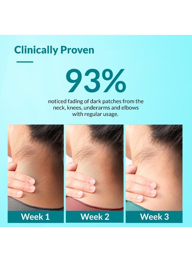 فيكسديرما كريم فيكسيرما نيجريفيكس لعلاج فرط التصبغ الأسود (Acanthosis Nigricans) بحمض اللاكتيك، مناسب لأجزاء الجسم كالرقبة، والكاحلين، والمفاصل، والإبطين، والفخذين، والمرفقين | مقشر ١٠٠ غرام (عبوة من قطعتين) - Image 3