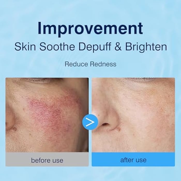 YAFUSIPE 3% Hyaluronic Acid Collagen Peptide Toner Pad, Hyaluronic Acid Toners Facial Pads Jelly Pad for Face Hydrating Facial Treatment Toner Cotton Wipe for Women Smoothing All Skin Types 100 Pads - Image 2