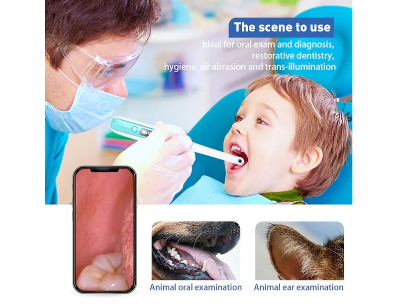 inskam401 Portable Handheld Reusable WIFI 2.0MP HD Intraoral Camera Endoscope of Teeth and Oral with 8 LEDs - Image 3