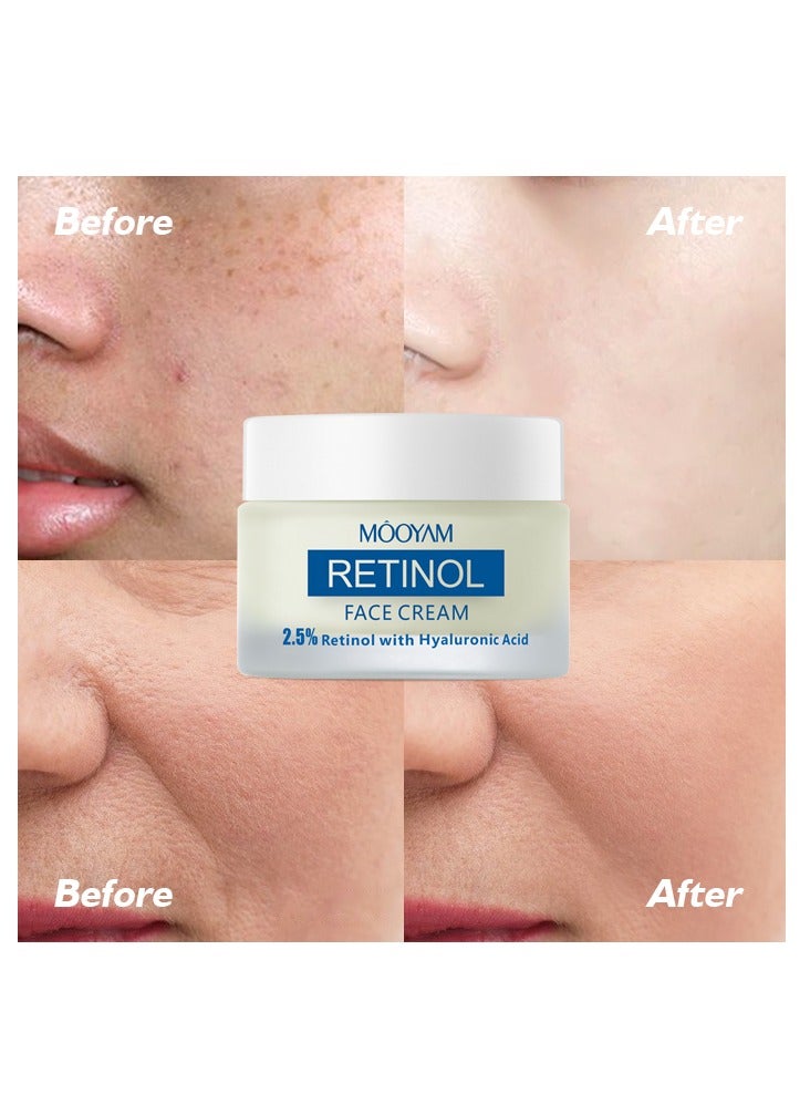 موويام كريم الريتينول 50 جرام كريم الريتينول للوجه لعلاج التجاعيد، 2.5٪ ريتينول مع حمض الهيالورونيك، كريم ترطيب للوجه لجميع أنواع البشرة - Image 5