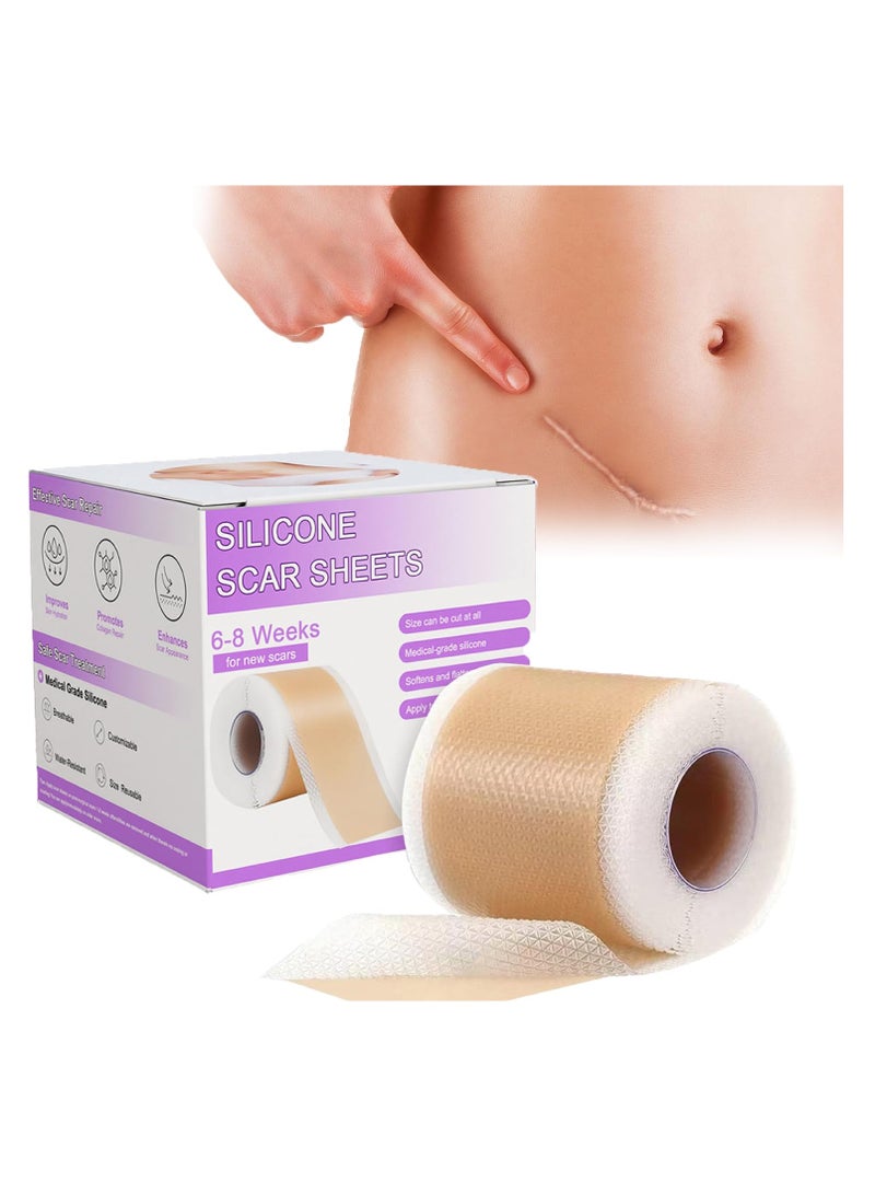 Joudi Professional Silicone Scar Removal Sticker for Post-Surgery C-Section Stretch Marks - Reusable Breathable Anti-Sun (4cm x 150cm)  - Image 2