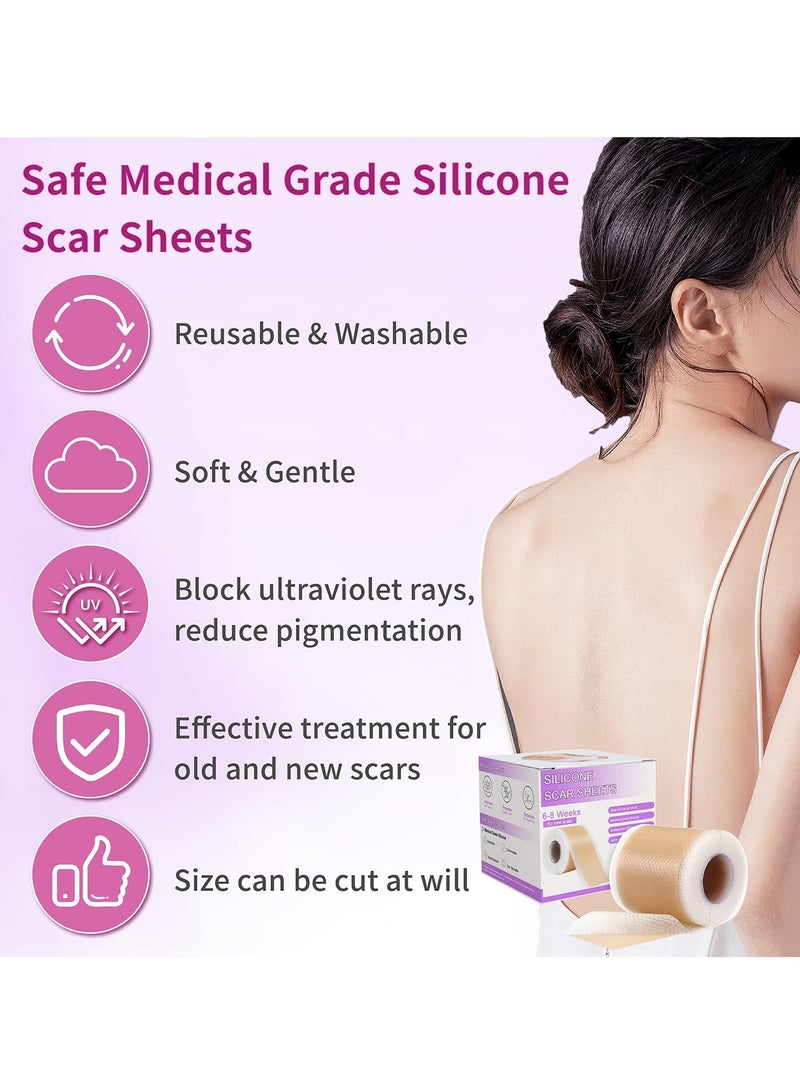 Joudi Professional Silicone Scar Removal Sticker for Post-Surgery C-Section Stretch Marks - Reusable Breathable Anti-Sun (4cm x 150cm)  - Image 5