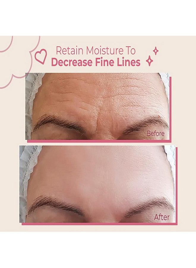 Bayside Forehead Wrinkle Patches | Non-Invasive Reusable Skin Care Solution | Fine Lines and Wrinkles Smoothing | Pairs with Eye Patches and Face Tape | Long-Lasting Skin Pads for a Smoother Look | Pack of 2 - Image 2