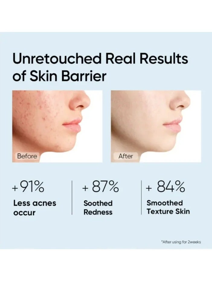 OUHOE Face Rosacea Treatment Cream, Fast Absorbing Anti Ageing Moisturizing Cream With Hyaluronic Acid,  Non Greasy Hydrating  Anti Wrinkle Barrier Repair Moisturizer Gel For Redness And Acnes  - Image 4