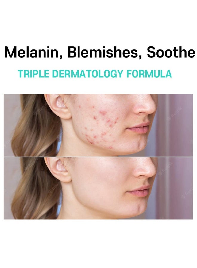 CARENEL Anti-Melasma Cica Cream, Melasma Treatment for Face Cream, Dark Spot Remover Centella Asiatica, Skin Care Beauty Products - Image 3