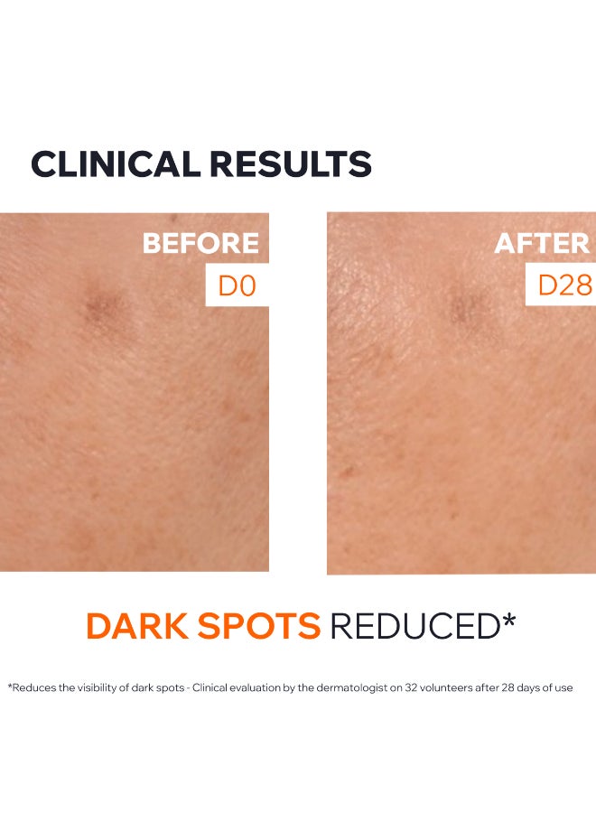 Uriage Dépiderm Anti-Dark Spot Brightening Serum with Vitamin C & Niacinamide - Skin Tone Corrector - 30ml - Image 5