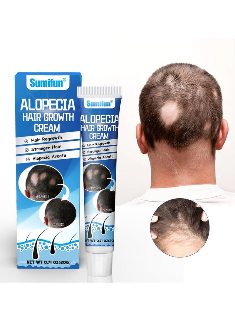 Sumifun - Alopecia Hair Growth Cream, 20g - Revitalizing Scalp and Promoting Hair Growth - Effective Treatment for Alopecia & Thinning Hair - Nourishes & Strengthens Hair Follicles - Reduces Hair Loss - Image 1