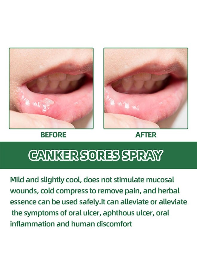 SOUTH MOON Canker Sore Treatment Spray 20ml，Herbal Ulcer Treatment,Natural Mouth Sore Relief for Daily Oral Care, Mouth Spray,Treat Mouth Ulcer,Effective Mouth Sore Treatment  - Image 3