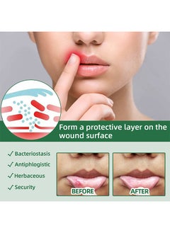 SOUTH MOON Canker Sore Treatment Spray 20ml，Herbal Ulcer Treatment,Natural Mouth Sore Relief for Daily Oral Care, Mouth Spray,Treat Mouth Ulcer,Effective Mouth Sore Treatment  - Image 4