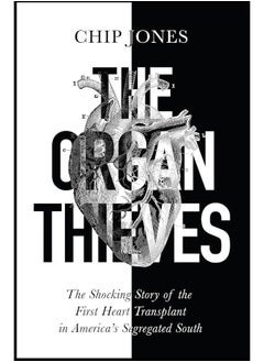 The Organ Thieves: The Shocking Story of the First Heart Transplant in America's Segregated South - pzsku/ZB318A3FD4439BE475A06Z/45/_/1726051362/1ec265bf-1b12-481d-9afb-2eb9abb0ba04