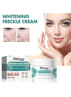 Whitening Freckle Cream,Pigmentation Removal Cream for Face,Freckle Remover Cream,Moisturizing Anti-blemish Cream,Dark Spots Remover Skin Whitening 30g