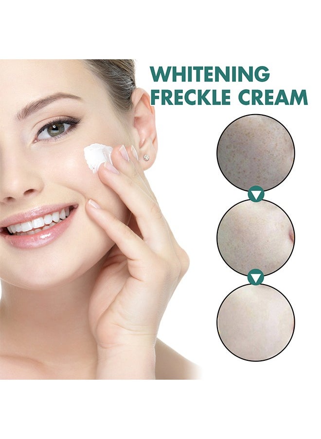 EELHOE - Whitening Freckle Cream,Pigmentation Removal Cream for Face,Freckle Remover Cream,Moisturizing Anti-blemish Cream,Dark Spots Remover Skin Whitening 30g - Image 1