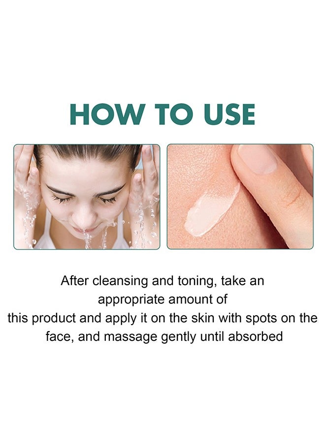 EELHOE - Whitening Freckle Cream,Pigmentation Removal Cream for Face,Freckle Remover Cream,Moisturizing Anti-blemish Cream,Dark Spots Remover Skin Whitening 30g - Image 1