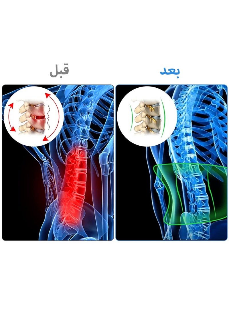 ليون هوم حزام دعم الظهر لتخفيف آلام أسفل الظهر ودعم العضلات والعمود الفقري - للرجال والنساء - Image 2