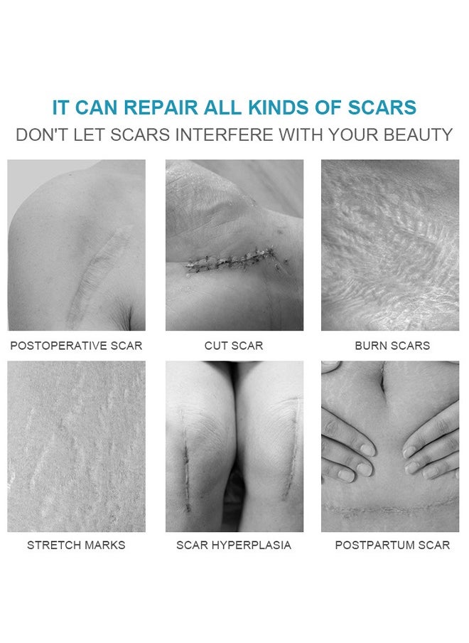 LANEMAY - Scar Cream, Medical Grade Silicone Scar Cream Advanced Scar Removal Gel For Surgical Scars Stretch Marks Acne Injury Burns Keloids Hypertrophic Old And New Scars 20G - Image 1