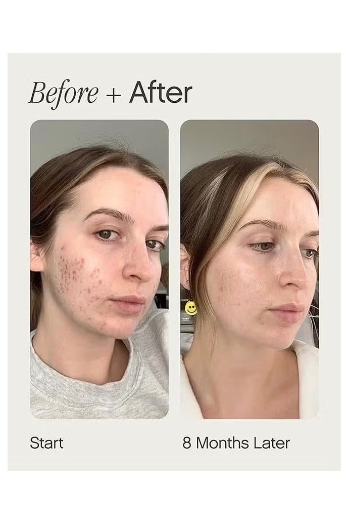 TOPICALS Brightening and Clearing Serum 15ml, Faded Serum for Dark Spots and Discoloration Hyperpigmentation, Postblemish Marks Scars And Spots, Mini Faded Serum for Uneven Skin Tone - Image 2