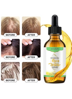 Sefudun Rice Water For Hair Growth, Hair Growth Oil, Rice Water Hair Growth Treatment For Stronger Thicker Longer Hair Regrowth, Prevent Hair Loss And Thinning For Men And Women 60ML  - Image 3