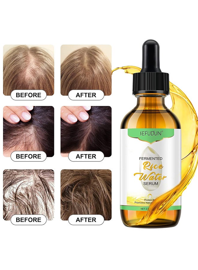 سيفودون ماء الأرز لنمو الشعر ، زيت نمو الشعر ، علاج نمو الشعر بماء الأرز لإعادة نمو الشعر لفترة أطول ، منع تساقط الشعر وترققه للرجال والنساء 60 مل - Image 3