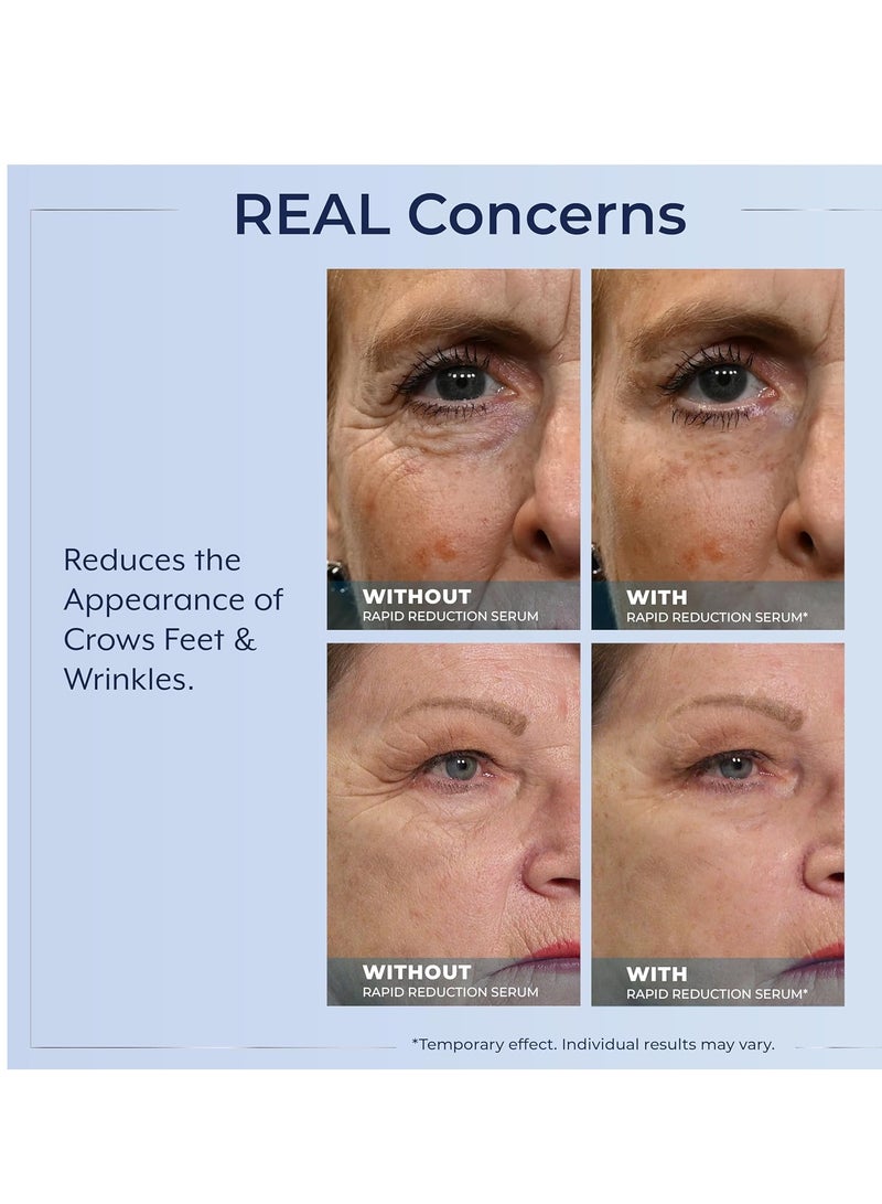 Plexaderm Rapid Reduction Eye Serum - Visibly Reduces Under-Eye Bags, Wrinkles, Dark Circles, Fine Lines & Crow's Feet Instantly, Anti Aging Wrinkle Remover for Face, 30 Single Use Pods