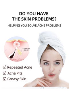 MOOYAM 2 Pcs Salicylic Acid Remove Acne Gel, Rapid Action Acne Spot Treatment for Face Closure & Acne Dots, Premium Acne Scar Gel & Pimple Remover, 20g  - Image 3