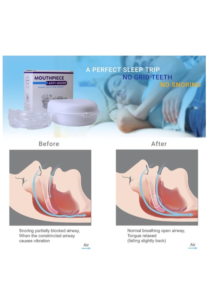جوي وورلد جهاز مكافحة الشخير، واقي الفم المضاد للشخير، واقي الفم المضاد للشخير لجميع أشكال الفم، مضاد للطحن، قابل لإعادة الاستخدام، حل فعال لتخفيف صريف الأسنان وطحن الأسنان للرجال والنساء (أبيض) - Image 4